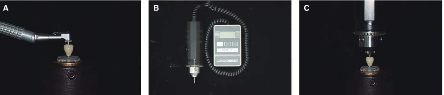 Fig. 3.  (A) Tightening the abutment screw with an insertion torque of 20 Ncm using a hand torque wrench