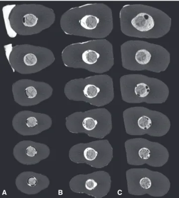 Fig. 1.  Representative micro-CT cross-sections (interval  of 500 µm) from the coronal, middle and apical thirds of  fiber posts with different resin cement