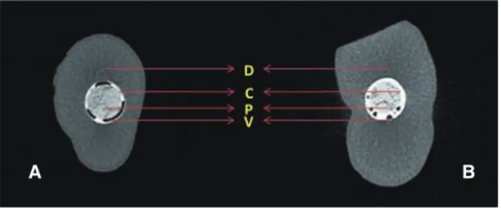 Fig. 5.  A representative 3D model of fiber post and  dispersion of void formations in continuity of post