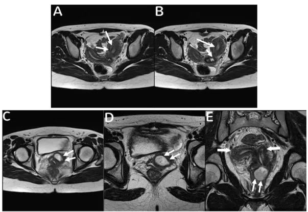 Fig. 1. T2 weighted MR images.