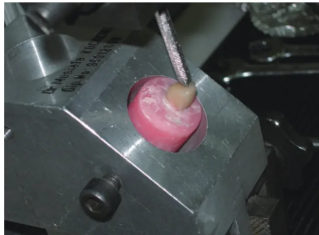 Fig. 1.  Each specimen was placed in a custom apparatus  that allowed the specimens to be positioned at 130  degrees to the buccal/lingual long axis.