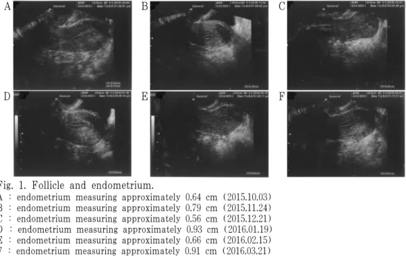 Fig. 1. Follicle and endometrium.