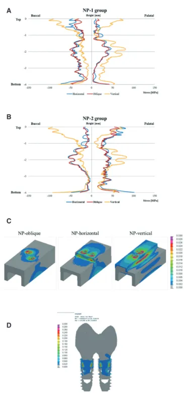 Fig. 4. von Mises stress distribution in three conditions of  2SIs under axial loading