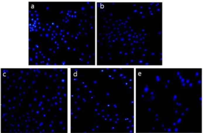 Fig.  5.  Effects  of  Angelicae  Acutilobae  Radix  (AA)  water  extract  on  chemical  ischemia・reperfusion  induced  production  of  apoptotic  body  in  SK-N-SH  cells  by  Hoechst  33342  staining