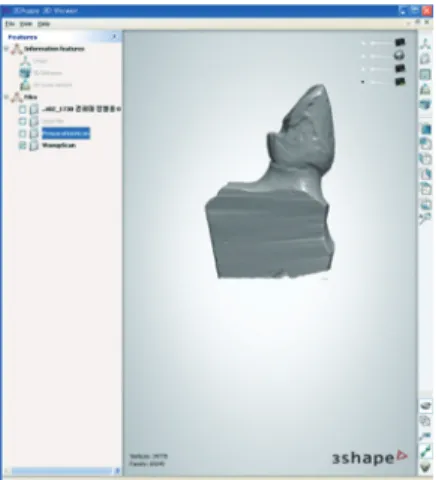 Fig. 3.  Resin pattern evaluated on the working cast die to  verify the fit (lingual view).