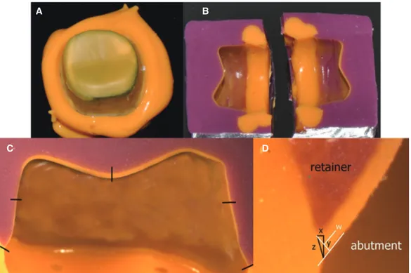 Fig. 3.  (A) Silicone films representing the space between the abutment teeth and prosthesis, (B) Stabilized replica after  segmentation in the bucco-lingual direction, (C) Measuring points of the cut silicone replica, (D) Microscopic  cross-sectional phot
