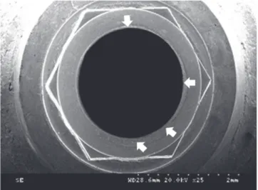 Fig. 6.  Representative SEM photograph at the interface of  abutment in the Gold group (arrows : remarkable wear  patterns, original magnification: ×50)