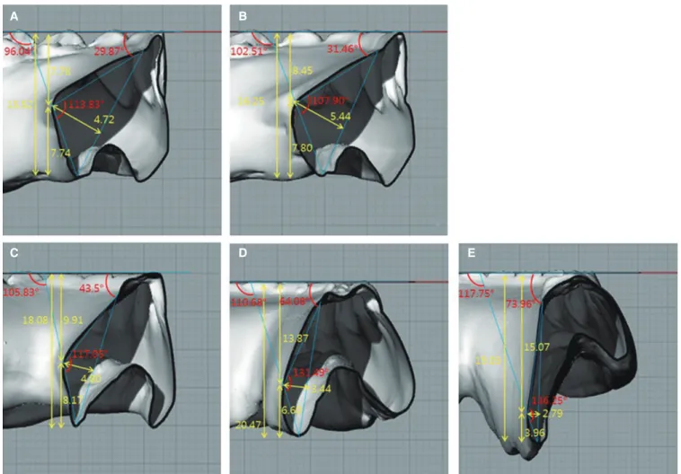 Fig. 5.  Contour and mean values of each region. (A) lingual frenum, (B) lateral incisor, (C) first premolar, (D) first molar,  (E) anterior border of retromolar pad.