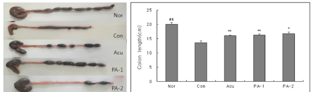 Fig. 1. Effects of HTTP on colon length in DSS-induced colitis in rats.