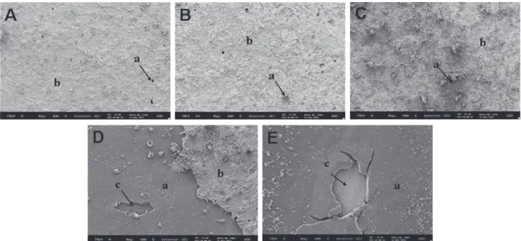 Fig. 4.  SEM micrograph of fractured surface after SBST (original magnification ×400)