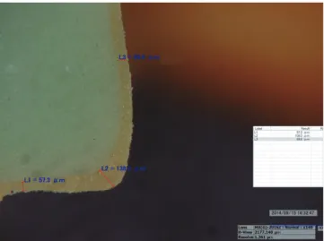 Fig. 2.  An image of a model at 140× magnification using  a digital microscope: L1; marginal gap, L2; rounded  chamfer, L3; axial wall.
