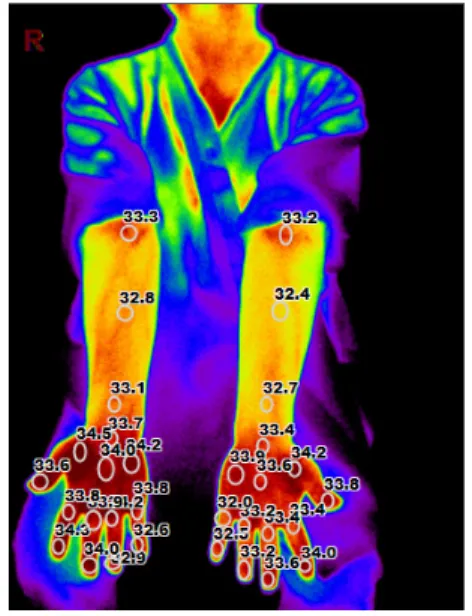 Fig.  3.  Digital  infrared  thermographic  imaging picture on 2015.07.31.