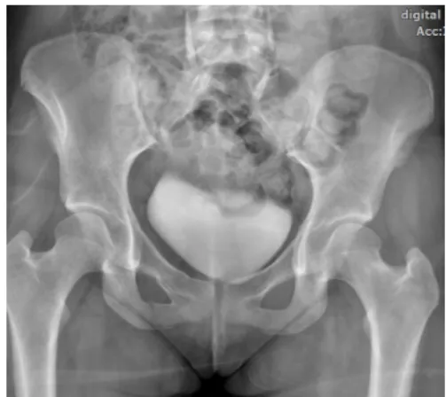 Fig. 1. Pelvis radiograph (15.1.29).