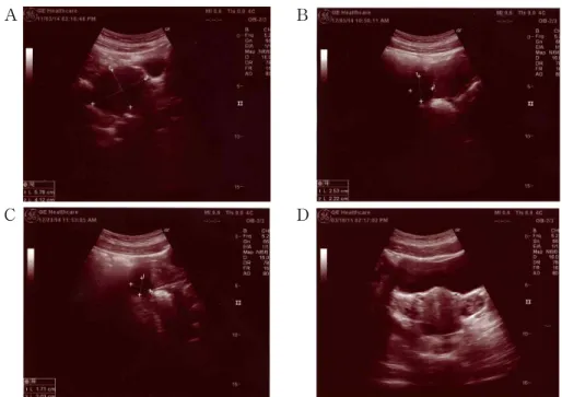 Fig. 2. Progress of sonography.