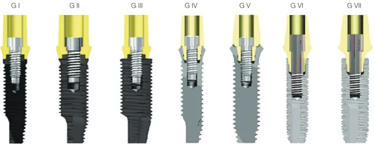 Fig. 1.  Sectional views of the implant fixture, abutment, and abutment screw assemblies