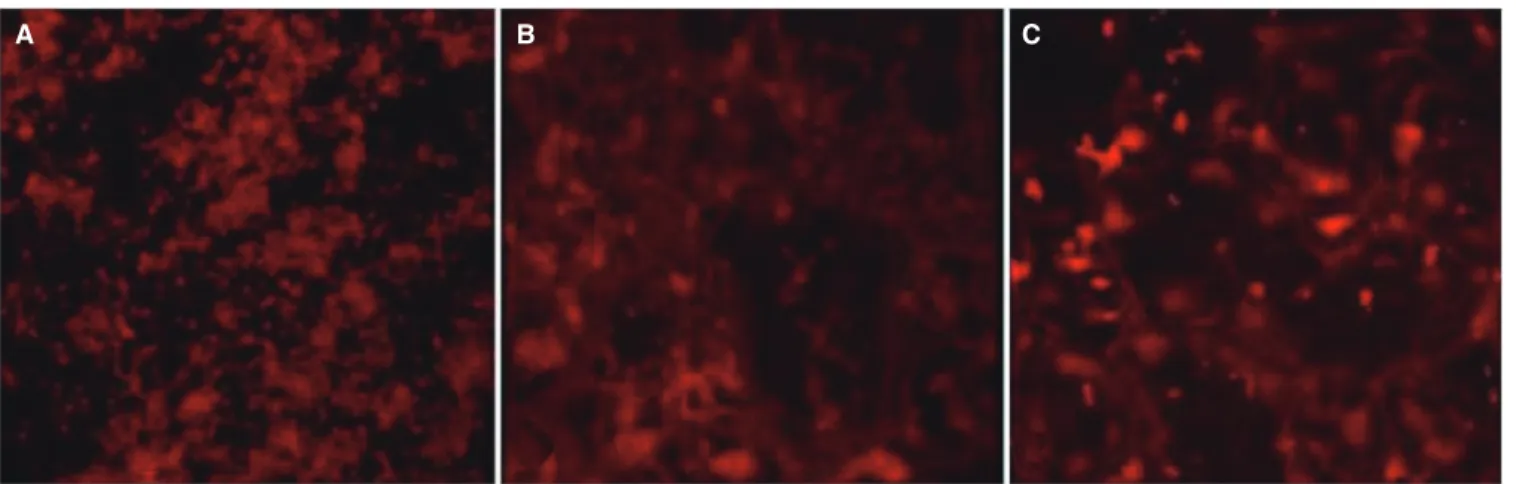 Fig. 6.  (A) OC - RT-PCR gene expression of TRAP of machined surface (M), Mg-implanted machined surface (MM)
