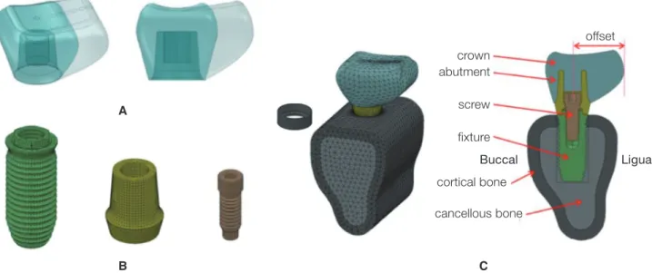 Fig. 1.  3D models used in this study. (A) Implant prosthesis with various level of lingual cantilever, (B) FE mesh of  external connection type implant system, (C) isometric and sectional view of 3D model.