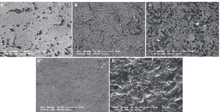 Fig. 4. The representative scanning electron microscope photographs of the control and pretreated ceramic surfaces  (Magnification ×1,000)