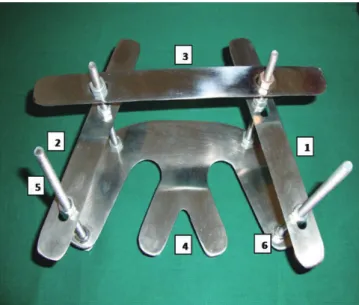 Fig. 1.  Occlusal plane analyzer assembled, 1-lateral  scale 1, 2-lateral scale 2, 3-front scale, 4-lower stainless  steel plate, 5-vertical threaded rods, 6-nuts to fix position 