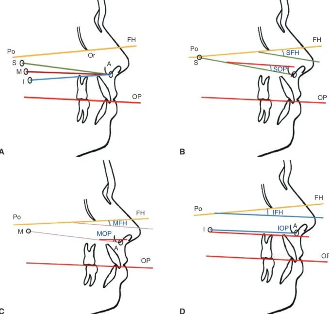 Fig. 5.  A: Placement of stainless steel balls at the located points of tragus and ala, B: 