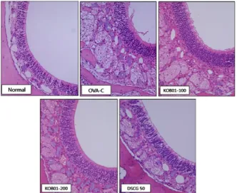 Fig.  3.  Effect  of  KOB01  on  histological  changes  of  nasal  mucosa  in  OVA-induced  allergic  rhinitis  mice