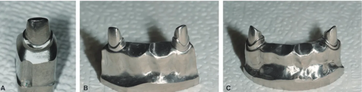 Fig. 1.  Titanium master model fabricated using CAD/CAM (Addtech Co., Seoul, Korea). A: single, B: 4-unit, C: 6-unit.