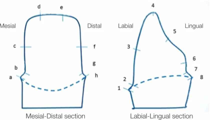 Fig. 4.  Reference points to measure the thickness of fit checker (Left: mesio-distal, Right: labio-lingual).
