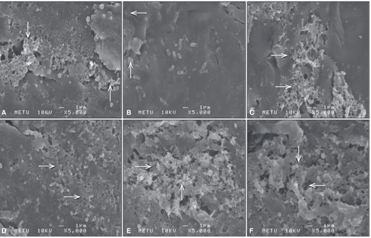 Table 3 shows the mean quantitative biofilm values and sta- sta-tistical significances according to microorganism and 