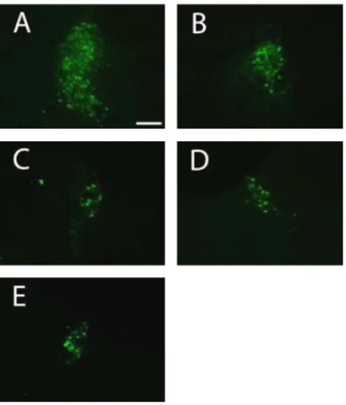 Fig.  11.  Photograph  of  TH-immunoreactive  cells  in  the  LC  (scale  bar  represents  200  ㎛)