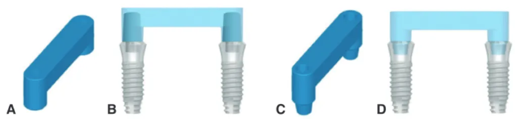 Fig. 1.  Measurement model with implant A and B. A  polyurethane resin block served as alveolar bone and two  implants were placed with an inter-implant distance of  15 mm.