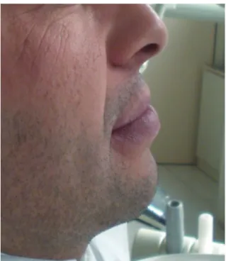 Fig. 1.  Lateral facial view of patient. 