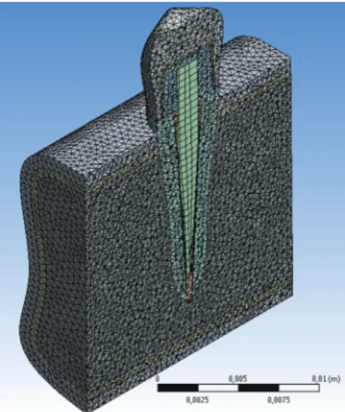 Fig. 3.  The meshed model had 262,160 elements and  401,161 nodes for oval fiber post and 263,443 elements  and 402,608 nodes for circular fiber post.
