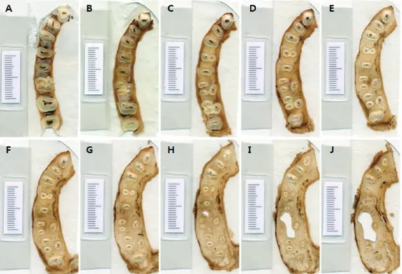 Fig. 1.  Sectioned specimens of the maxillary arch from 1 mm (upper left) to 10 mm (lower right) below the cervical line