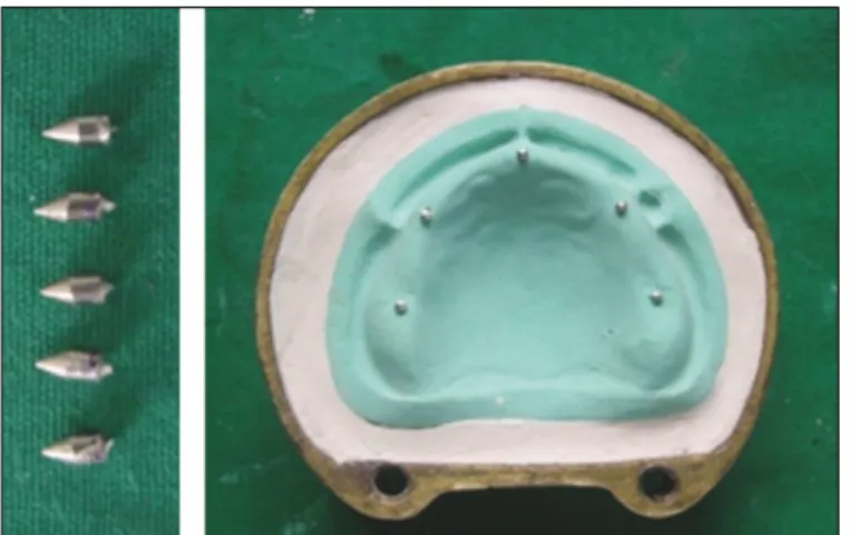Fig. 6. The 1.5 mm larger cast retrieved using mould-3. Fig. 7. Denture base with relining.