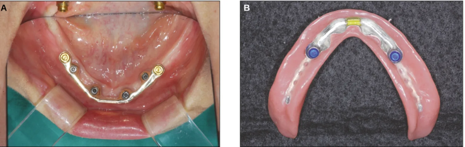 Fig. 7. Post-operative panoramic radiograph.