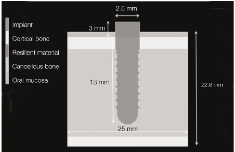 Fig. 1. Implant, abutment and bone.