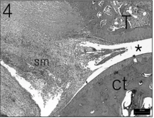 Fig.  6.  Bone  destruction  and  reactive  periosteal  bone  of  the  tibia  from  control  group  at  20  days  after  Complete  Freund's  Adjuvant  injection