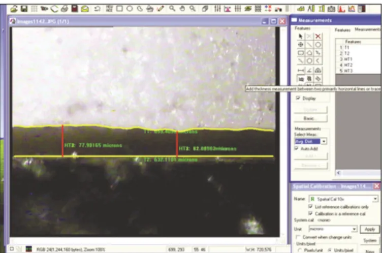 Fig. 4. Tracing of die and coping margins with image analyzing software.