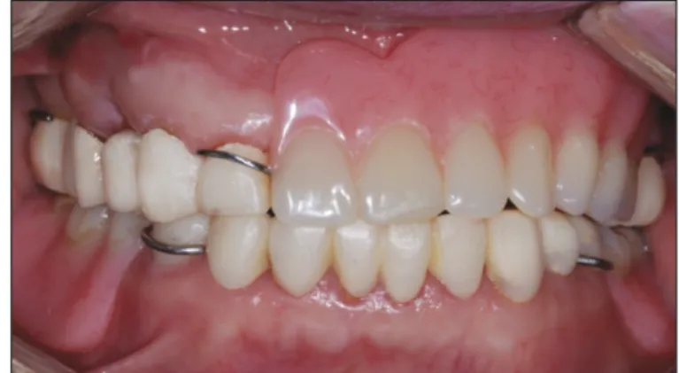 Fig. 1. Initial intraoral status. Fig. 2. Provisional restoration.