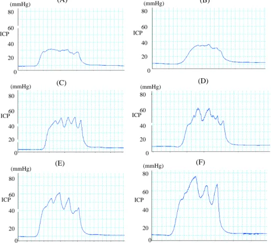 Fig.  2.  Original  tracing  stimulated  at  frequency  of  2  Hz  before  HTE001  administration 