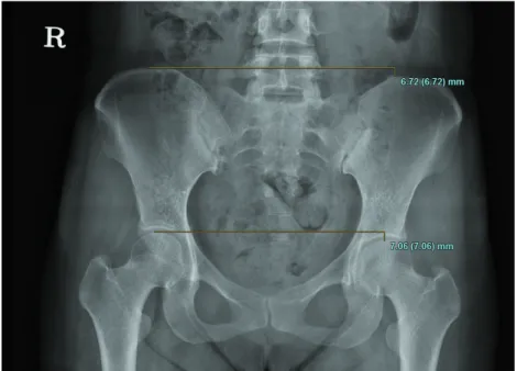 Fig. 1. Pelvis AP(2013. 7. 8).
