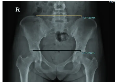 Fig. 2. Pelvis AP(2013. 8. 13).