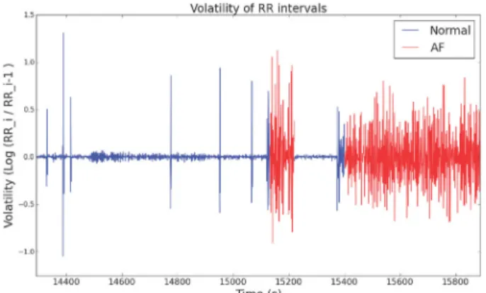 Figure 1. Comparison between Variability of Heart Rate Intervals in  Normal Status and Atrial Fibrillation Status(Record 08455  in MIT-BIH atrial fibrillation database)