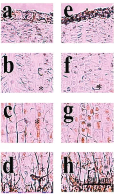 Fig.  8.  The  longitudinal  height  of  growth  plate.  Normal: 