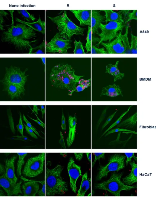 Figure 4. Confocal microscopic analysis of  M. abscessus infected cells. Each cell was infected with RFP over-expressive MAB and  stained with beta-tubulin of  green and nucleus of  blue