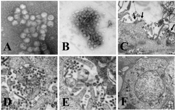 Figure 1. Electron microscopy of  QIAG93 isolates. QIAG9301 was used as a representative of  the three isolates