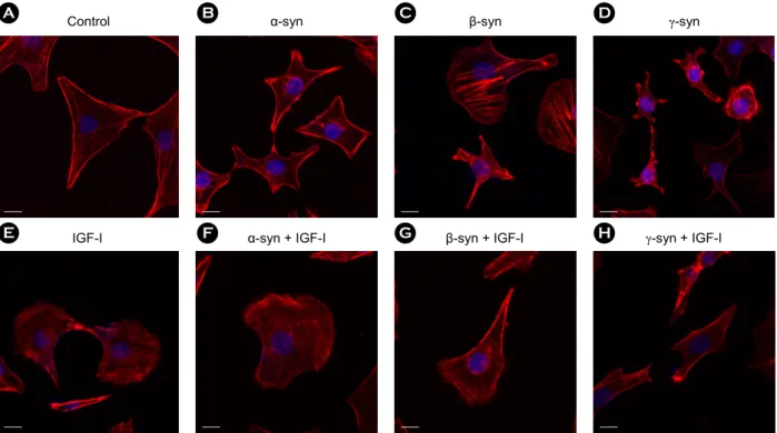 Figure 9. The recombinant synucleins and IGF-I induced the membrane ruffling formation of SKOV-3