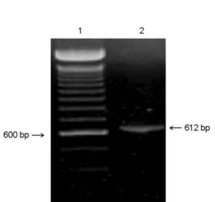 Figure 1. Amplification of  CNV-1 ORF5. Lanes: 1, 100 bp  ladder; 2, CNV-1. The numbers on both sides indicate the size in bp.