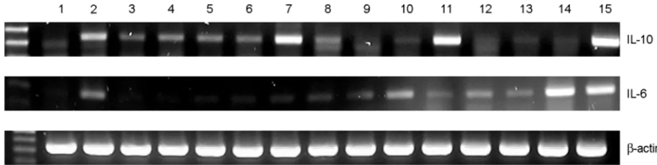 Figure 2. Expression of IL-10 mRNA in mouse peritoneal macrophage treated with various Bifidus strains