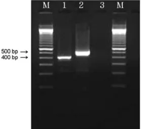Figure 7. Multiplex PCR to distinguish an intact selC locus  from one disrupted by LEE